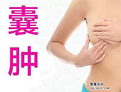 乳腺囊肿的症状表现是什么?