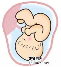 胎儿脐绕颈是怎么回事