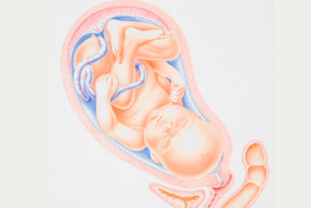 胎盘早期剥离的原因有什么?