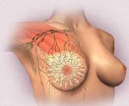治疗女性乳腺增生的方法有哪些呢?