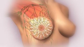 乳腺炎的危害有哪些
