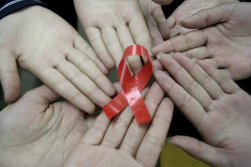 艾滋病的初期症状有哪些?