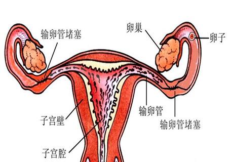 了解女性输卵管不孕的症状及如何预防