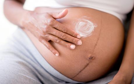 怀孕几个月会长妊娠纹? 该如何预防？