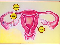 最常见的卵巢良性肿瘤 诊断依据是什么