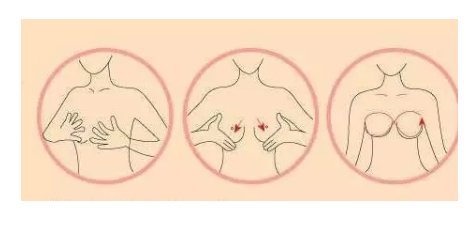 如何保护乳房，远离乳腺疾病