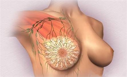 乳腺肿块的症状表现及如何治疗和护理方法
