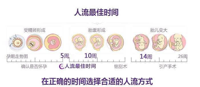 广元女性怀孕多久可以做人流