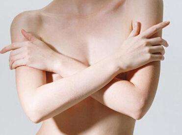 一分钟教你自测乳腺问题 双侧乳腺小叶增生注意