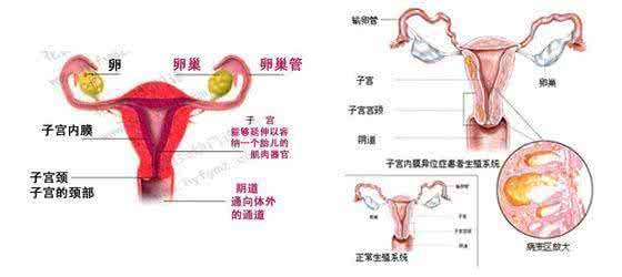 子宫内膜息肉的病因和相关因素及预防复发策略