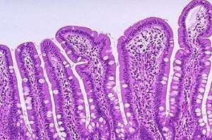 男性生殖器念球菌有哪些症状？需要注意些什么？