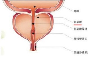 男性前列腺脓肿的5种表现让你提前发现疾病！