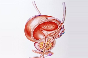 前列腺结核对人体有哪些危害？得了前列腺结核应该怎么办？ ...