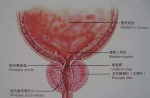 男性如何保养前列腺？教你4种保养前列腺方法