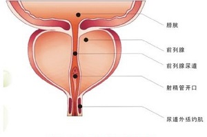 前列腺增生有哪些症状？前列腺增生的预防方法有哪些？
