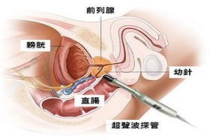 男性前列腺位置在哪里？前列腺的功能有哪些？